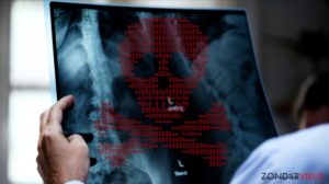 Criminelen kunnen medische scanresultaten vervalsen via netwerk aanvallen vanop afstand